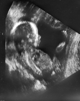ultrasound20weeks132220092.jpg